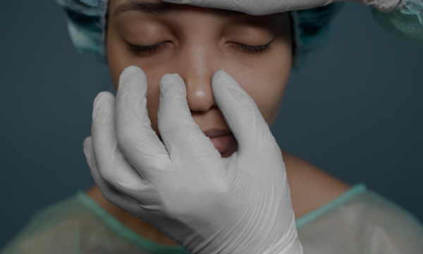 RINOPLASTIA CONVENCIONAL RINOPLASTIA ULTRASÓNICA EN MALAGA CUAL ELEGIR rinoplastia ultrasonica en malaga
