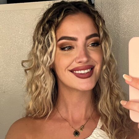 rinoplastia ultrasónica cerrada en malaga paola después rinoplastia ultrasónica cerrada en malaga paola después