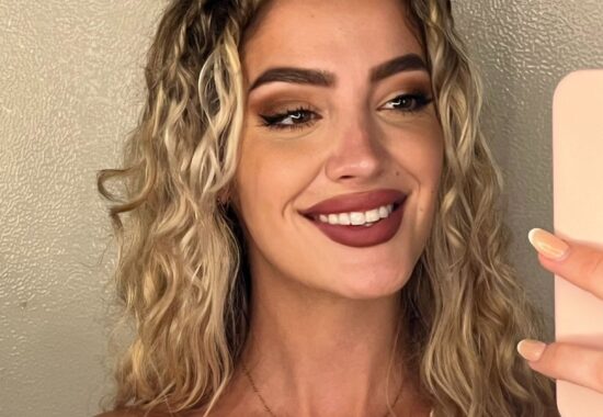 rinoplastia ultrasónica cerrada en malaga paola después rinoplastia ultrasónica cerrada en malaga paola después