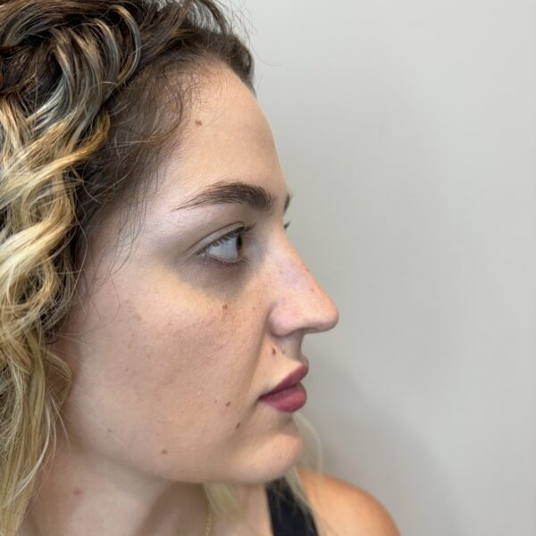 antes paola antes paola