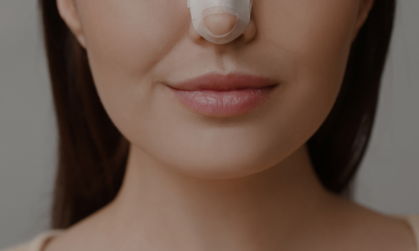 cual es el precio de una rinoplastia (2) cual es el precio de una rinoplastia (2)