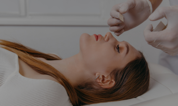 Cuidados tras una rinoplastia Cuidados tras una rinoplastia