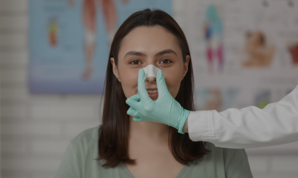que puedo hacer tras una rinoplastia que puedo hacer tras una rinoplastia