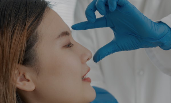 rinoplastia cerrada ventajas rinoplastia cerrada ventajas