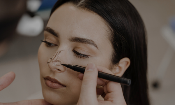 rinoplastia armonica y natural rinoplastia armonica y natural