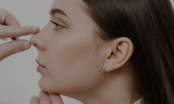 rinoplastia ultrasónica en malaga rinoplastia ultrasónica en malaga