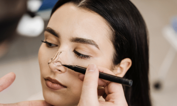 10 preguntas frecuentes en rinoplastia 10 preguntas frecuentes en rinoplastia
