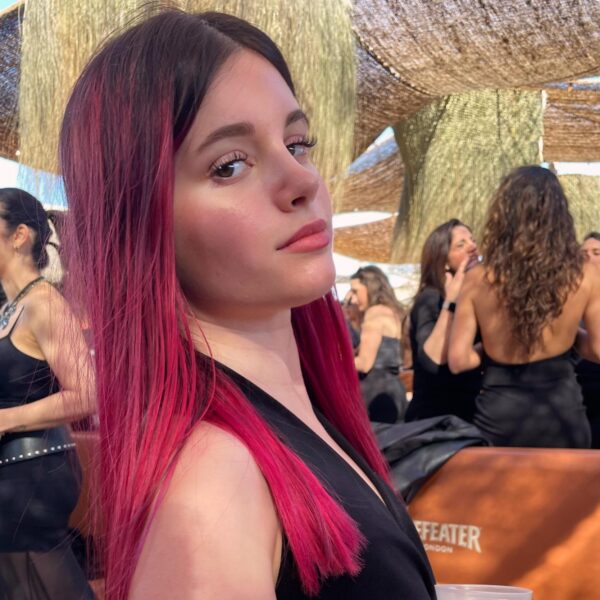 Irina Rivas Irina rivas cirugía de nariz