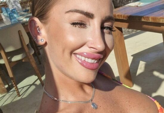rinoplastia en málaga rinoplastia en málaga