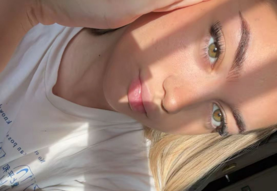 rinoplastia en malaga rebel notes caso real de rinoplastia