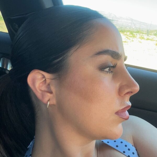 rinoplastia ultrasonica en malaga rinoplastia ultrasonica en malaga