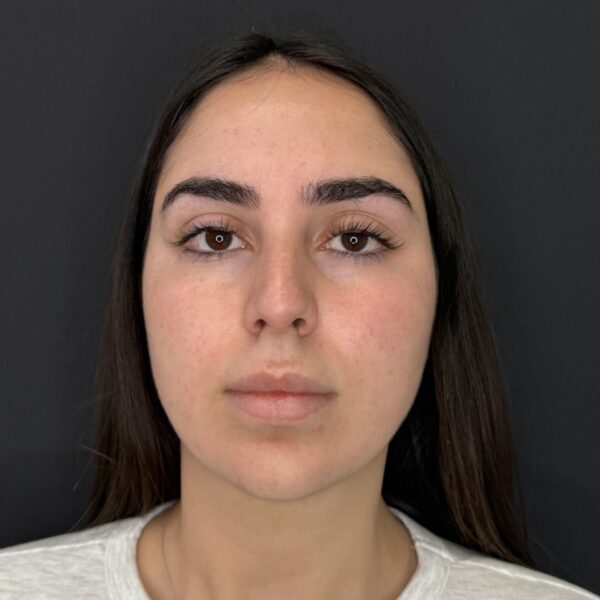 lucia roja antes 3 lucia roja antes 3